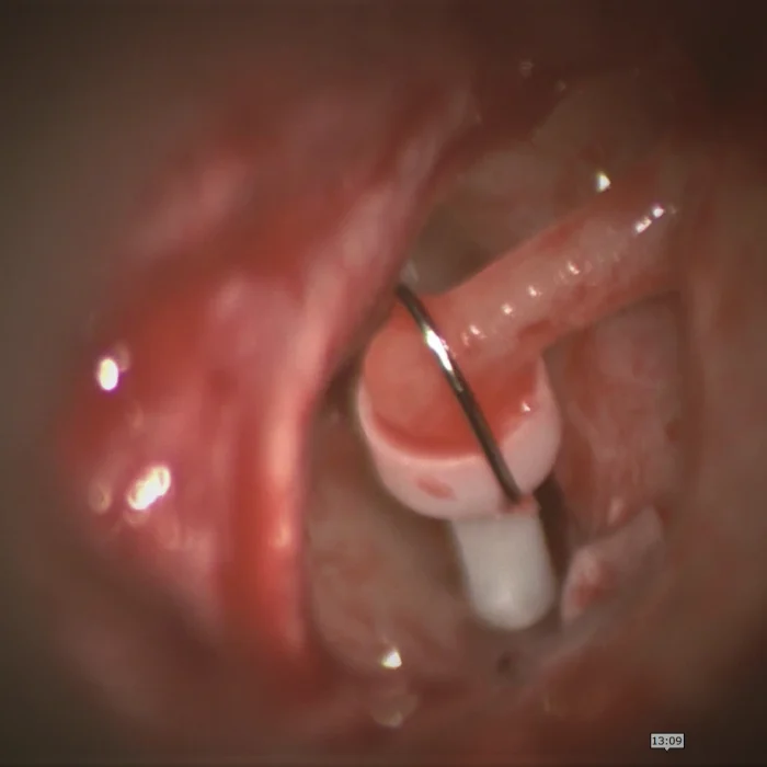 CIRUGIA-MICRO-OIDO-JPEG