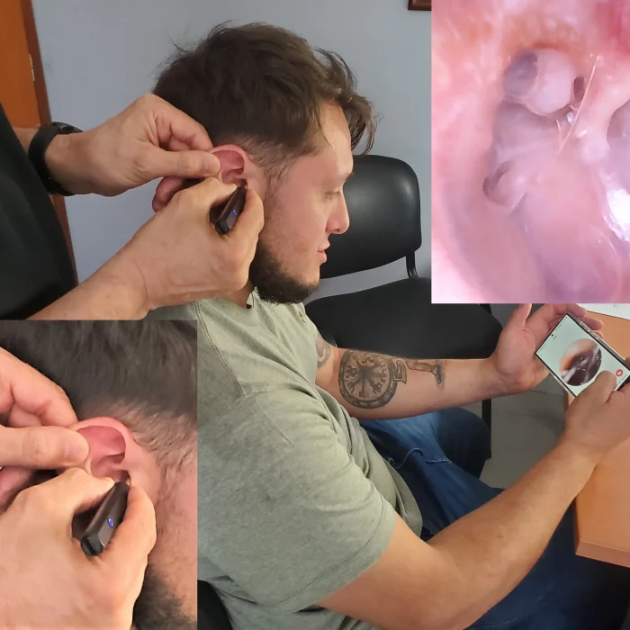 TRIPTICO-ENDOTOSCOPIA-jpeg
